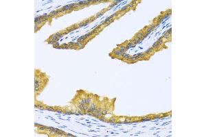 Immunohistochemistry of paraffin-embedded human prostate using BTD antibody at dilution of 1:100 (40x lens). (BTD anticorps)