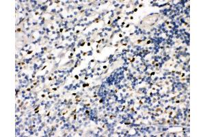 Anti-FLI1 antibody, IHC(P) IHC(P): Human Tonsil Tissue