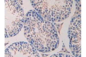 Detection of LAMa4 in Mouse Testis Tissue using Polyclonal Antibody to Laminin Alpha 4 (LAMa4)