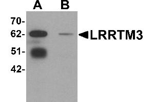 Western Blotting (WB) image for anti-Leucine Rich Repeat Transmembrane Neuronal 3 (LRRTM3) (C-Term) antibody (ABIN1030498) (LRRTM3 anticorps  (C-Term))
