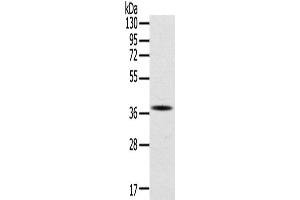 Western Blotting (WB) image for anti-Secreted Protein, Acidic, Cysteine-Rich (Osteonectin) (SPARC) antibody (ABIN2422187) (SPARC anticorps)