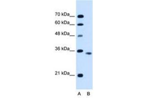 Image no. 1 for anti-Activin A Receptor, Type IIB (ACVR2B) (C-Term) antibody (ABIN6736679) (ACVR2B anticorps  (C-Term))