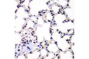 Immunohistochemistry of paraffin-embedded rat lung using UBE2B antibody at dilution of 1:100 (x40 lens).