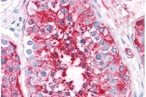 Human Testis: Formalin-Fixed, Paraffin-Embedded (FFPE) (ADAM20 anticorps  (Internal Region))