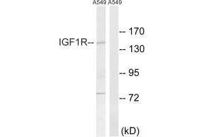 Western blot analysis of extracts from A549 cells, using IGF1R (Ab-1346) antibody.