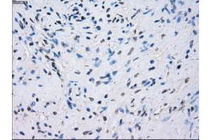 Image no. 1 for anti-Fc gamma RII (CD32) antibody (ABIN1497257)