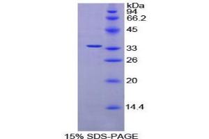 SDS-PAGE analysis of Rat AMY2 Protein. (AMY2 Protéine)