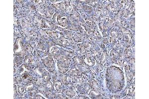 IHC analysis of SAP130 using anti-SAP130 antibody (ABIN7601247). (SAP130 anticorps  (AA 309-913))