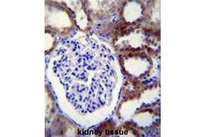 CASP3 Antibody (C-term) immunohistochemistry analysis in formalin fixed and paraffin embedded human kidney tissue followed by peroxidase conjugation of the secondary antibody and DAB staining. (Caspase 3 anticorps  (C-Term))