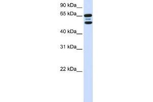 WB Suggested Anti-FBXO21 Antibody Titration:  0. (FBXO21 anticorps  (N-Term))