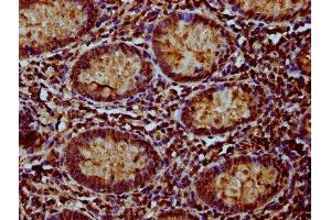IHC image of ABIN7160882 diluted at 1:100 and staining in paraffin-embedded human appendix tissue performed on a Leica BondTM system. (NDUFAF3 anticorps  (AA 91-184))