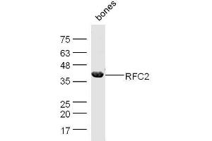 Mouse bone lysates probed with Rabbit Anti-RFC2 Polyclonal Antibody, Unconjugated  at 1:500 for 90 min at 37˚C. (RFC2 anticorps  (AA 281-354))