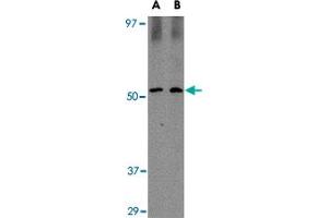 Western blot analysis of SIRT2 in Mouse brain tissue lysate with SIRT2 polyclonal antibody  at (A) 1 and (B) 2 ug/mL . (SIRT2 anticorps  (C-Term))