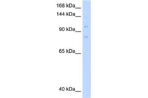 WB Suggested Anti-MCM8 Antibody Titration:  0.