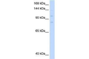 WB Suggested Anti-MCM8 Antibody Titration:  0. (MCM8 anticorps  (C-Term))