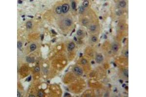 Used in DAB staining on fromalin fixed paraffin-embedded Liver tissue (IFNA2 anticorps  (AA 24-188))