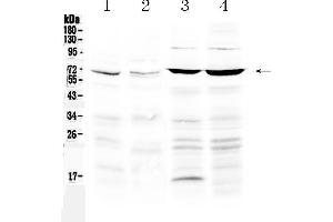 Western blot analysis of PPAR gamma using anti-PPAR gamma antibody . (PPARG anticorps  (Middle Region))