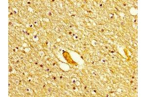 IHC image of ABIN7150227 diluted at 1:300 and staining in paraffin-embedded human brain tissue performed on a Leica BondTM system. (POLD1 anticorps  (Catalytic Subunit))