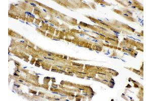 Cofilin 2 was detected in paraffin-embedded sections of mouse cardiac muscle tissues using rabbit anti- Cofilin 2 Antigen Affinity purified polyclonal antibody (Catalog # ) at 1 µg/mL.