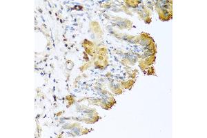 Immunohistochemistry of paraffin-embedded mouse lung using VTN antibody at dilution of 1:100 (40x lens). (Vitronectin anticorps)