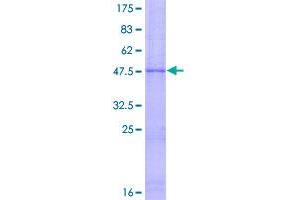 Image no. 1 for TIMP Metallopeptidase Inhibitor 3 (TIMP3) (AA 1-211) protein (GST tag) (ABIN1322792)