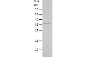 Western Blotting (WB) image for Hydroxysteroid Dehydrogenase Like 2 (HSDL2) (AA 212-363) protein (His-IF2DI Tag) (ABIN7123392)