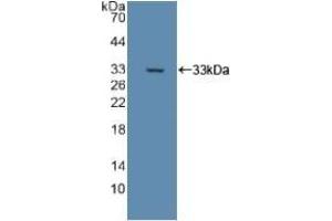 Detection of Recombinant DLD, Rat using Polyclonal Antibody to Dihydrolipoyl Dehydrogenase (DLD) (DLD anticorps)