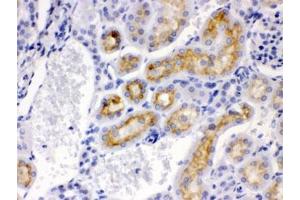 IHC testing of FFPE mouse kidney with CYP24A1 antibody. (CYP24A1 anticorps  (AA 153-514))