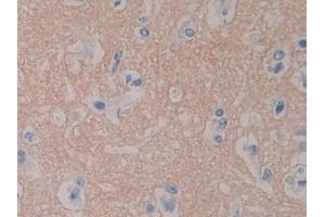 DAB staining on IHC-P; Samples: Human Cerebrum Tissue