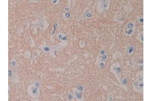 DAB staining on IHC-P; Samples: Human Cerebrum Tissue (RPN1 anticorps  (AA 24-179))