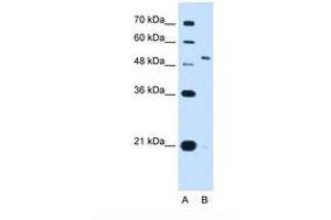 Image no. 1 for anti-Potassium Voltage-Gated Channel, Shaw-Related Subfamily, Member 1 (KCNC1) (AA 21-70) antibody (ABIN321117) (KCNC1 anticorps  (AA 21-70))