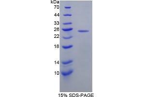 Image no. 1 for O6-Methylguanine-DNA-Methyltransferase (MGMT) (AA 1-207) protein (His tag) (ABIN6236815)