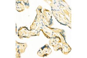 Immunohistochemistry of paraffin embedded human placenta using GRASP (ABIN7074140) at dilution of 1:400 (400x lens)