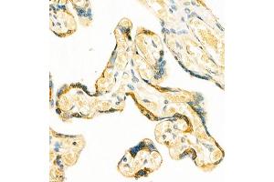 Immunohistochemistry of paraffin embedded human placenta using GRASP (ABIN7074140) at dilution of 1:400 (400x lens)