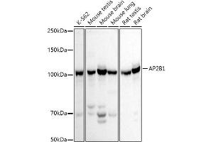 Western blot analysis of extracts of various cell lines, using B1 antibody (ABIN3015809, ABIN3015810, ABIN3015811 and ABIN6219156) at 1:500 dilution. (AP2B1 anticorps  (AA 752-951))