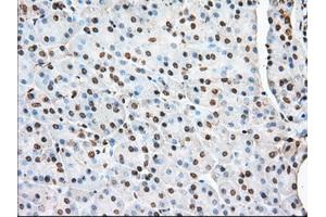 Immunohistochemical staining of paraffin-embedded Human liver tissue using anti-ACAT2 mouse monoclonal antibody. (ACAT2 anticorps)