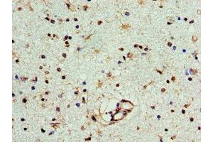 Immunohistochemistry of paraffin-embedded human brain tissue using ABIN7166631 at dilution of 1:100