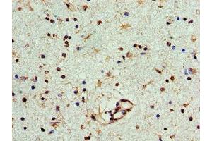 Immunohistochemistry of paraffin-embedded human brain tissue using ABIN7166631 at dilution of 1:100 (PNP anticorps  (AA 1-289))