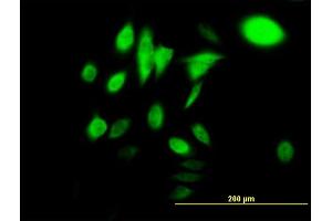 Immunofluorescence of monoclonal antibody to HSPA1B on HeLa cell.