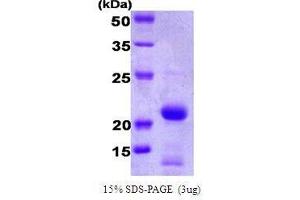 Figure annotation denotes ug of protein loaded and % gel used. (BID Protein (AA 1-195))