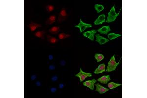 ABIN6263942 and ABIN6269236 staining HepG2 cells by IF/ICC.
