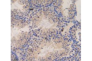 Used in DAB staining on fromalin fixed paraffin- embedded testis tissue (SSFA2 anticorps  (AA 587-802))