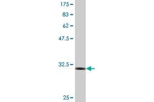 Western Blot detection against Immunogen (32.