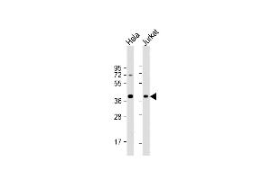All lanes : Anti-HSP40 Antibody at 1:4000 dilution Lane 1: Hela whole cell lysate Lane 2: Jurkat whole cell lysate Lysates/proteins at 20 μg per lane. (DNAJB1 anticorps)