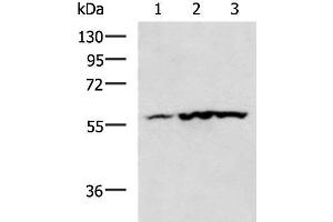 Western blot analysis of Mouse heart tissue Human heart tissue Rat heart tissue lysates using CAMK2G Polyclonal Antibody at dilution of 1:400 (CAMKII gamma anticorps)