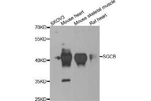 Western blot analysis of extracts of various cell lines, using SGCB antibody. (SGCB anticorps)