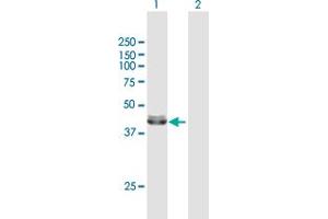 Western Blot analysis of ACADM expression in transfected 293T cell line by ACADM MaxPab polyclonal antibody. (Medium-Chain Specific Acyl-CoA Dehydrogenase, Mitochondrial (MCAD) (AA 1-421) anticorps)