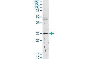 C1QB MaxPab rabbit polyclonal antibody.