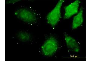 Immunofluorescence of monoclonal antibody to ZAK on HeLa cell.