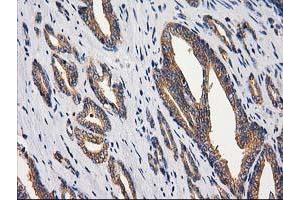 Image no. 5 for anti-Glucosidase, Beta, Acid 3 (Cytosolic) (GBA3) (AA 1-150), (AA 370-469) antibody (ABIN1490582)